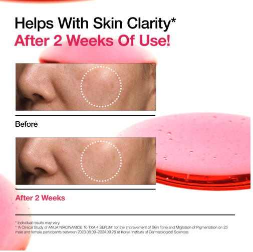 Niacinamide 10 TXA 4 Serum for Brightening and Dark Spots